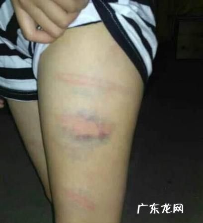 罚跑步属于体罚学生,罚学生跑步5圈算不算体罚