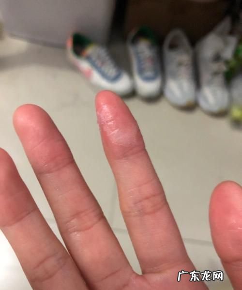 0胶整手上怎么去掉,0胶整手上怎么去掉