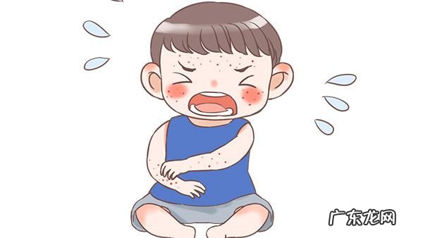 湿疹怎么引起的,湿疹是怎样形成的什么原因引起的