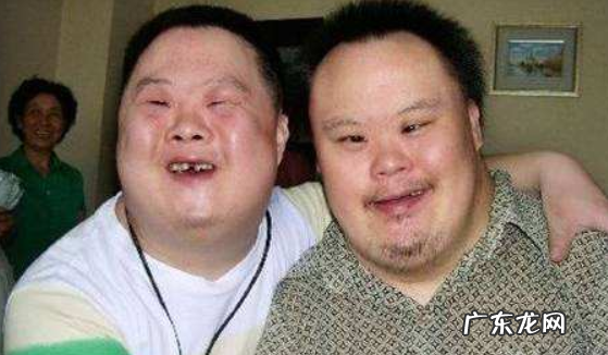 什么叫唐氏儿,唐氏儿筛查是什么意思