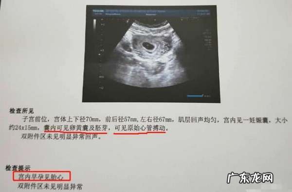 第一次产检是什么时候,怀孕后多久开始第一次产检