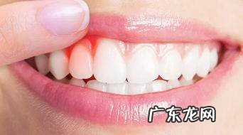 一刷牙就出血怎么办,刷牙牙龈容易出血是什么原因