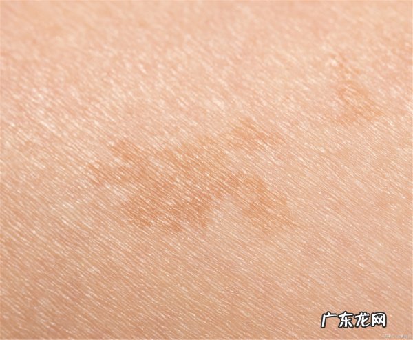 吃完麻辣烫能吃榴莲,吃了火锅以后吃啥可以分解