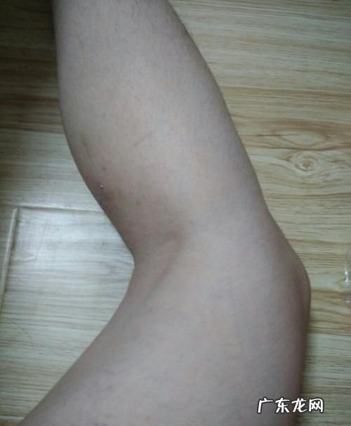 睡觉膝盖出汗怎么回事,手脚冰冷是什么原因怎么治
