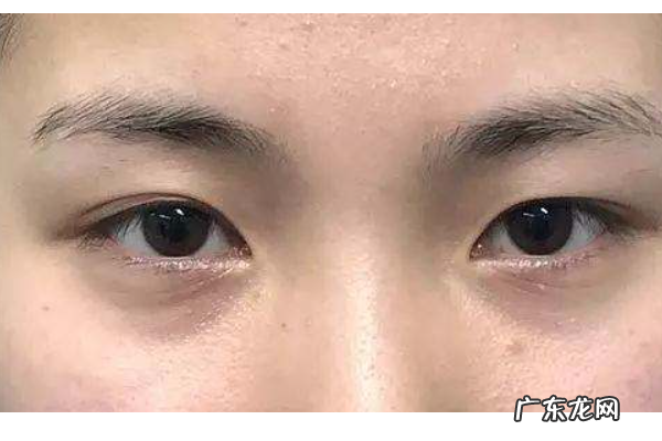 一眼单一眼双是什么眼,眼睛一单一双是什么面相