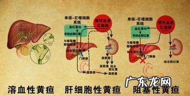 乙肝有什么炎症状表现,得了乙肝的症状和表现有哪些