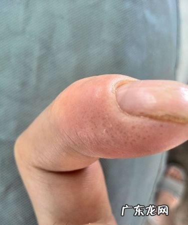 右手小拇指发麻是怎么回事,晚上睡觉两手小拇指和无名指发麻是什么原因