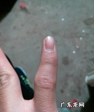 右手小拇指发麻是怎么回事,晚上睡觉两手小拇指和无名指发麻是什么原因