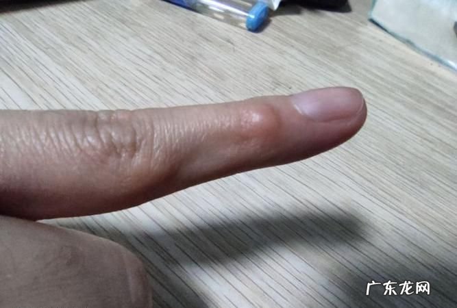 右手小拇指发麻是怎么回事,晚上睡觉两手小拇指和无名指发麻是什么原因