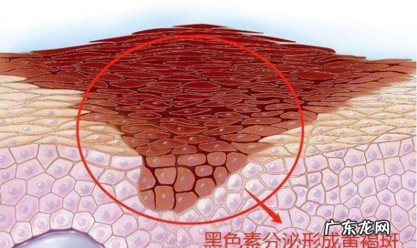 企鹅流鼻涕的原因是什么,企鹅有鼻子和耳朵
