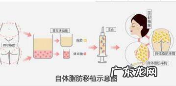 肿胀液可以喝,常喝红牛会不会伤肝