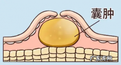 胰腺浆液囊腺瘤有什么风险,胰腺假性囊肿会自己消失
