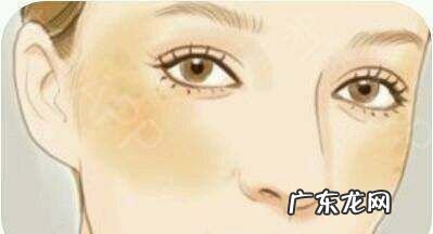 黄褐斑和雀斑的区别,雀斑黄褐斑怎么区分