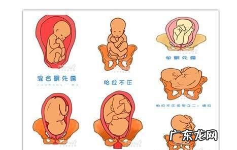宝宝胎位不正怎么办,胎位不正的原因及矫正方法图解