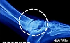 韧带越压越硬是为什么,为什么有些人韧带很硬