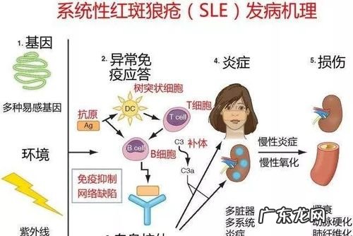 红斑狼疮怎么买重疾险,红斑狼疮能投保险