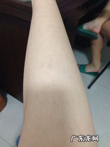 如何去掉腿上的汗毛,怎样去除腿毛去除腿毛的方法