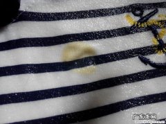 怎么样去除衣服上的斑点,应该怎么去除衣服上的霉点