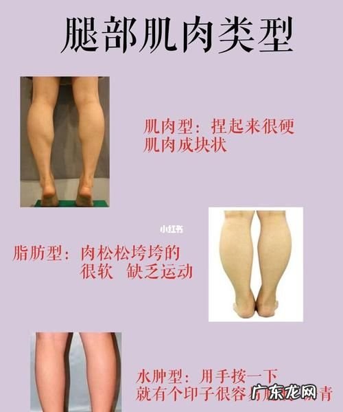 小腿水肿怎么消除,小腿浮肿和脚面浮肿怎么治疗