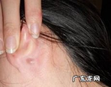 耳朵长痘痘是什么原因,耳朵里长了一个痘痘是怎么回事